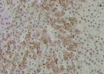 Phospho-PKC alpha (Tyr365) Antibody in Immunohistochemistry (Paraffin) (IHC (P))