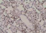 Phospho-PKC alpha (Tyr365) Antibody in Immunohistochemistry (Paraffin) (IHC (P))