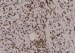 Phospho-PKC alpha (Tyr195) Antibody in Immunohistochemistry (Paraffin) (IHC (P))