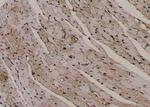 Phospho-PKC alpha (Tyr195) Antibody in Immunohistochemistry (Paraffin) (IHC (P))