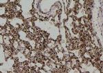 Phospho-PKC alpha (Tyr195) Antibody in Immunohistochemistry (Paraffin) (IHC (P))