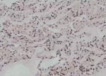 Phospho-UBF-1 (Thr117) Antibody in Immunohistochemistry (Paraffin) (IHC (P))