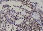 Phospho-VEGF Receptor 1 (Tyr1048) Antibody in Immunohistochemistry (Paraffin) (IHC (P))