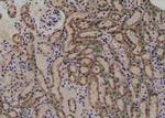 Phospho-VEGF Receptor 1 (Tyr1048) Antibody in Immunohistochemistry (Paraffin) (IHC (P))