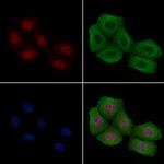 Phospho-ATF1 (Ser198) Antibody in Immunocytochemistry (ICC/IF)