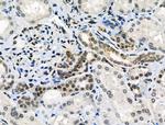 Phospho-ATF1 (Ser198) Antibody in Immunohistochemistry (Paraffin) (IHC (P))