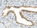 Phospho-ATF1 (Ser198) Antibody in Immunohistochemistry (Paraffin) (IHC (P))