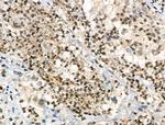 Phospho-ATF1 (Ser198) Antibody in Immunohistochemistry (Paraffin) (IHC (P))