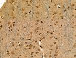 Phospho-ATF1 (Ser198) Antibody in Immunohistochemistry (Paraffin) (IHC (P))