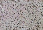 Phospho-ATF1 (Ser198) Antibody in Immunohistochemistry (Paraffin) (IHC (P))