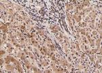 Phospho-PLCG1 (Tyr472) Antibody in Immunohistochemistry (Paraffin) (IHC (P))