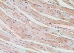 Phospho-PLCG1 (Tyr472) Antibody in Immunohistochemistry (Paraffin) (IHC (P))