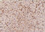 Phospho-PLCG1 (Tyr472) Antibody in Immunohistochemistry (Paraffin) (IHC (P))