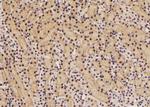 Phospho-eIF2 beta (Tyr298) Antibody in Immunohistochemistry (Paraffin) (IHC (P))