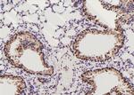 Phospho-MAK (Thr157) Antibody in Immunohistochemistry (Paraffin) (IHC (P))