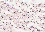 Phospho-ErbB3 (Tyr1197) Antibody in Immunohistochemistry (Paraffin) (IHC (P))