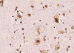 Phospho-ErbB3 (Tyr1197) Antibody in Immunohistochemistry (Paraffin) (IHC (P))