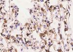 Phospho-ErbB3 (Tyr1197) Antibody in Immunohistochemistry (Paraffin) (IHC (P))