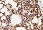 Phospho-ErbB3 (Tyr1222) Antibody in Immunohistochemistry (Paraffin) (IHC (P))