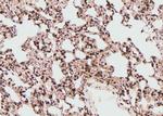 Phospho-FGFR4 (Tyr642) Antibody in Immunohistochemistry (Paraffin) (IHC (P))