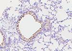 Phospho-c-Cbl (Ser804) Antibody in Immunohistochemistry (Paraffin) (IHC (P))