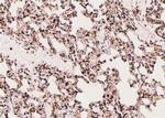 Phospho-Cofilin (Tyr140) Antibody in Immunohistochemistry (Paraffin) (IHC (P))