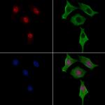 Phospho-GATA3 (Ser369) Antibody in Immunocytochemistry (ICC/IF)