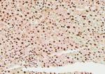 Phospho-RNA pol II CTD (Tyr145) Antibody in Immunohistochemistry (Paraffin) (IHC (P))