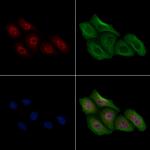 Phospho-MCM3 (Ser160) Antibody in Immunocytochemistry (ICC/IF)