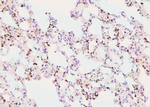 Phospho-IKB alpha (Tyr42) Antibody in Immunohistochemistry (Paraffin) (IHC (P))