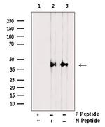 Phospho-IKB alpha (Tyr42) Antibody in Western Blot (WB)