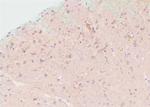 Phospho-EphA2 (Ser897) Antibody in Immunohistochemistry (Paraffin) (IHC (P))