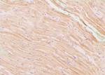 Phospho-EphA2 (Ser897) Antibody in Immunohistochemistry (Paraffin) (IHC (P))