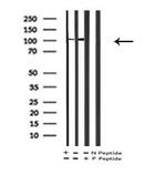 Phospho-EphA2 (Ser897) Antibody in Western Blot (WB)