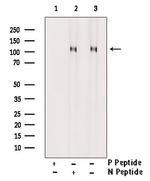 Phospho-EphA2 (Ser897) Antibody in Western Blot (WB)