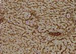 Phospho-EphA2 (Thr587) Antibody in Immunohistochemistry (Paraffin) (IHC (P))