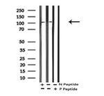 Phospho-EphA2 (Thr587) Antibody in Western Blot (WB)