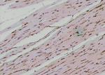 Phospho-EphA2 (Ser901) Antibody in Immunohistochemistry (Paraffin) (IHC (P))