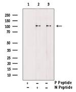 Phospho-EphA2 (Ser901) Antibody in Western Blot (WB)