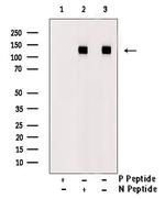 Phospho-EphA3 (Tyr596) Antibody in Western Blot (WB)