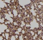 Phospho-EphA3 (Tyr779) Antibody in Immunohistochemistry (Paraffin) (IHC (P))