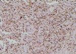 Phospho-NF2 (Ser13) Antibody in Immunohistochemistry (Paraffin) (IHC (P))