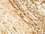 Phospho-MYH9 (Tyr754) Antibody in Immunohistochemistry (Paraffin) (IHC (P))