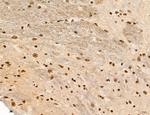 Phospho-FLT3 (Tyr631) Antibody in Immunohistochemistry (Paraffin) (IHC (P))