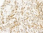 Phospho-FLT3 (Tyr631) Antibody in Immunohistochemistry (Paraffin) (IHC (P))