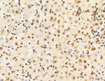 Phospho-FLT3 (Tyr631) Antibody in Immunohistochemistry (Paraffin) (IHC (P))