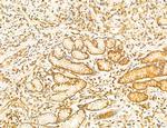 Phospho-SREBP1 (Ser338) Antibody in Immunohistochemistry (Paraffin) (IHC (P))