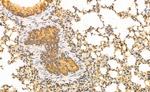 Phospho-SREBP1 (Ser338) Antibody in Immunohistochemistry (Paraffin) (IHC (P))