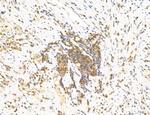 Phospho-GluR1 (Ser836) Antibody in Immunohistochemistry (Paraffin) (IHC (P))