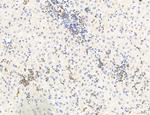 Phospho-GluR1 (Ser836) Antibody in Immunohistochemistry (Paraffin) (IHC (P))